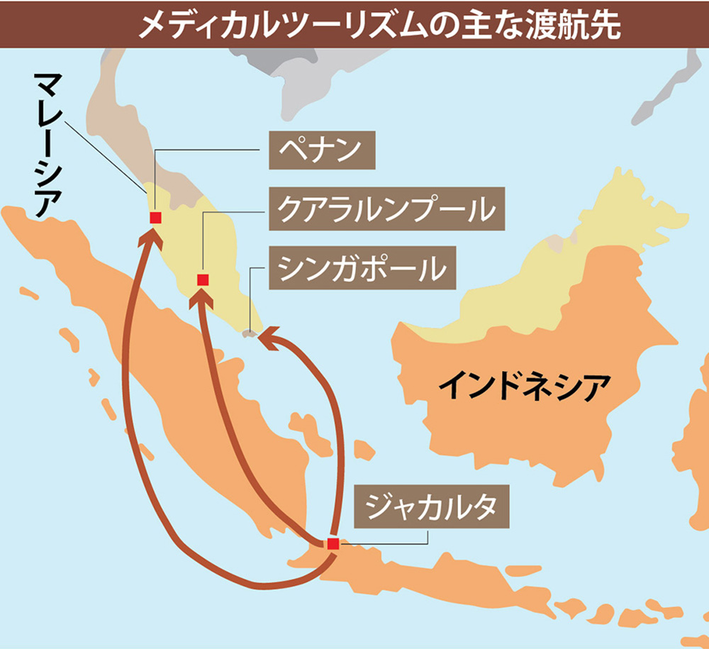 インドネシアの医療を考える  ㊤　年間1000億円の医療費流出　増加するメディカルツーリズム